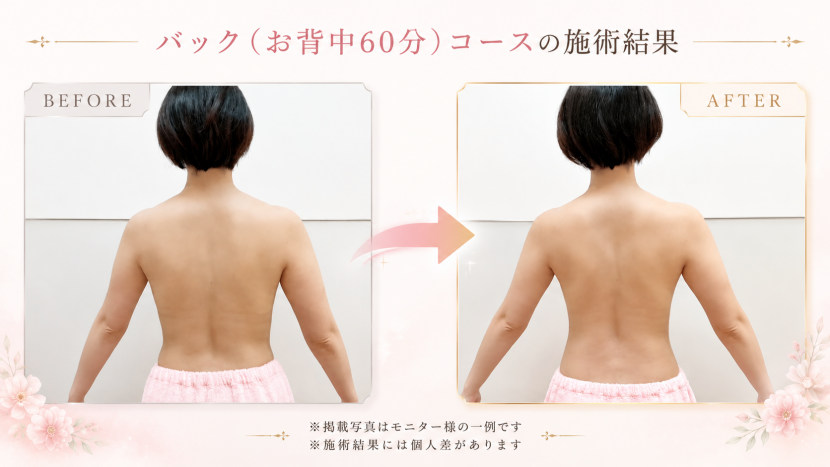 バック(お背中60分)コースのご紹介